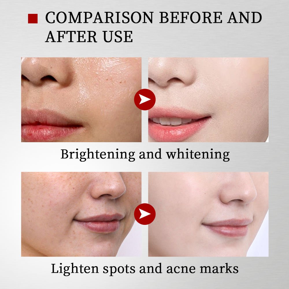 Whitening and Repair Cream