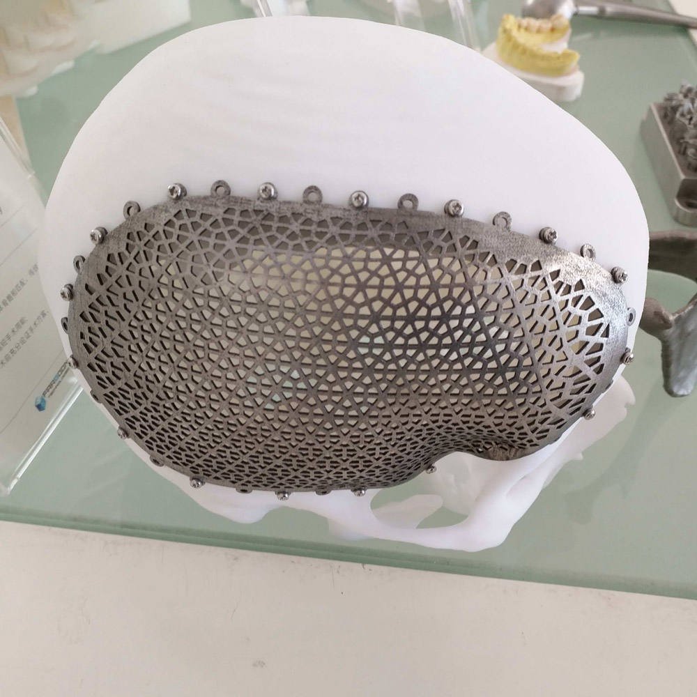 3D Print with Metal | Leading Metal 3D Printer | Metal 3D Printing